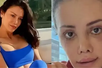 DİDEM CERAN'IN ESKİ HALİ: Didem Ceran yüz nakli yaptırmadan önce nasıldı, Didem Ceran'ın yüzünde kaç tane estetik var?