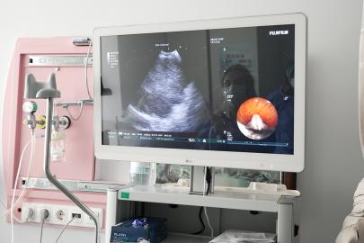 Doç. Dr. Berber: EBUS özellikle akciğer kanseri tanısında kritik rol oynuyor