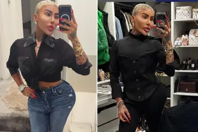 Kim Kardashian'a benzemek için estetik yaptıran fenomen hayatını kaybetti: 2 kişi cinayetten tutuklandı