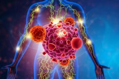 Vücuttaki gizli kanser hücrelerine dikkat! Görüntüleme ve testler her zaman yeterli mi?