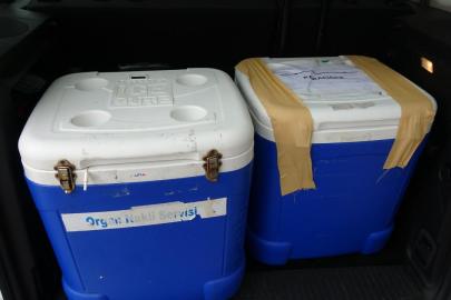 Genç kadının organları 3 kişiye umut oldu