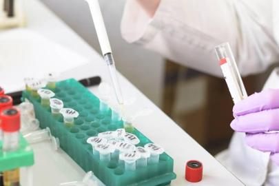 Gıda ve çevre konulu uluslararası projelere destek sağlanacak