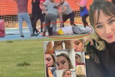 "Artık utanmıyorum" diyerek yaşadıklarını anlattı. Zonguldak'ta eski eşe tekme-tokat dayak
