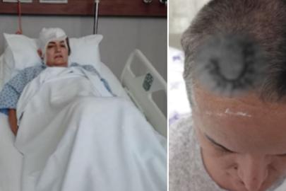 Diş ağrısı için gitti hayatı karardı. Şimdi beyninde ömür boyu cihazla yaşayacak